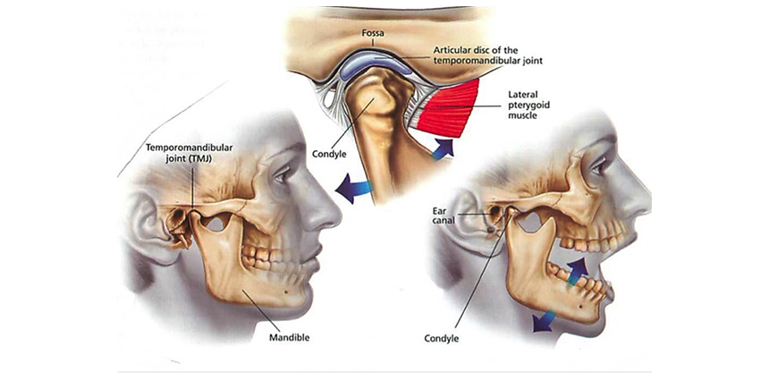 TMJ Clinic